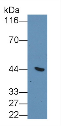 Monoclonal Antibody to Cytokeratin 19 (CK19)