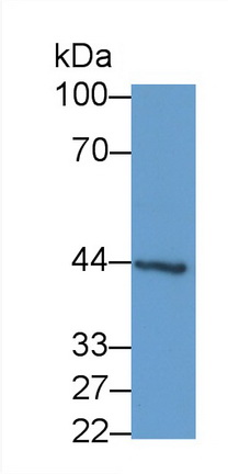 Monoclonal Antibody to Cytokeratin 19 (CK19)