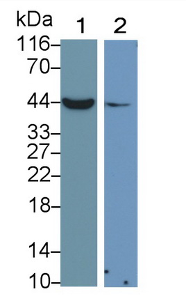 Monoclonal Antibody to Cytokeratin 19 (CK19)