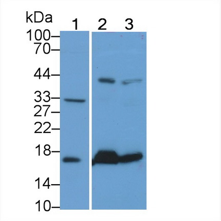 Monoclonal Antibody to Heart-type Fatty Acid Binding Protein (H-FABP)