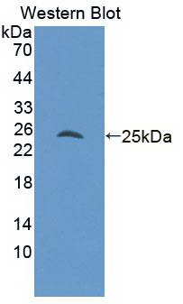 Monoclonal Antibody to Androgen Receptor (AR)