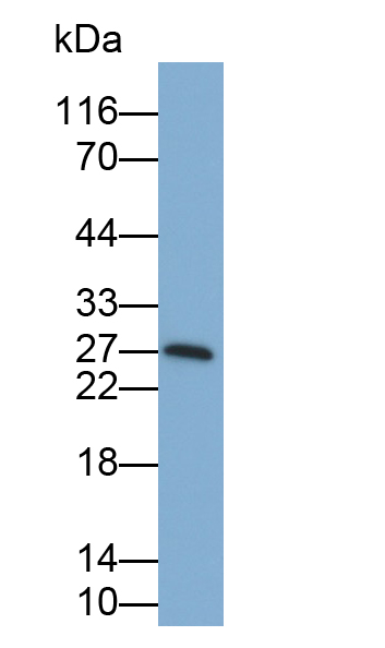 Monoclonal Antibody to Glutamate Decarboxylase 2 (GAD2)