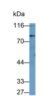 Monoclonal Antibody to Lipase, Hormone Sensitive (LIPE)