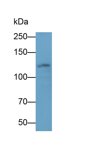 Monoclonal Antibody to Integrin Alpha V (ITGaV)