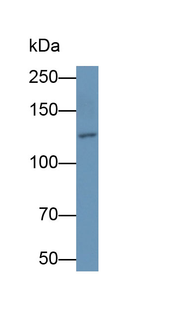 Monoclonal Antibody to Integrin Alpha V (ITGaV)