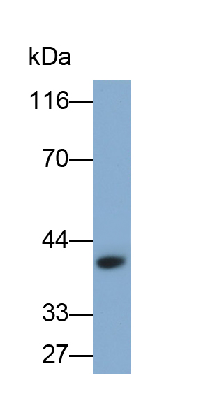 Monoclonal Antibody to Epithelial Cell Adhesion Molecule (EPCAM)