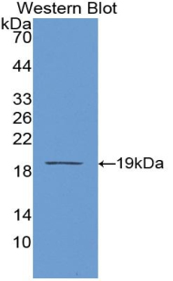 Monoclonal Antibody to Procollagen C-Endopeptidase Enhancer (PCOLCE)