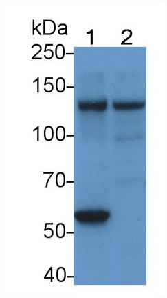 Monoclonal Antibody to Focal Adhesion Kinase (FAK)