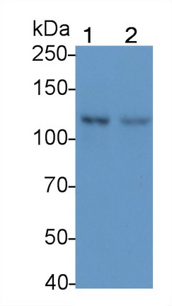 Monoclonal Antibody to Focal Adhesion Kinase (FAK)