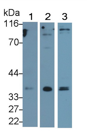 Monoclonal Antibody to Beta-1,3-Glucuronyltransferase 1 (b3GAT1)