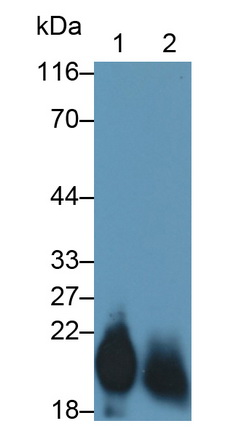 Monoclonal Antibody to Cluster of Differentiation 59 (CD59)