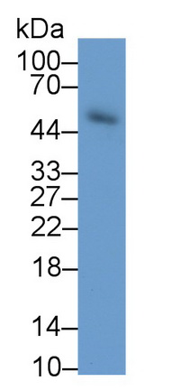 Monoclonal Antibody to Elastin (ELN)