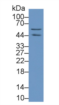 Monoclonal Antibody to Beta Actin (ACTB)