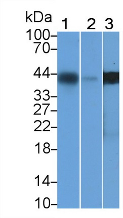 Monoclonal Antibody to Actin Alpha 1, Cardiac Muscle (ACTC1)