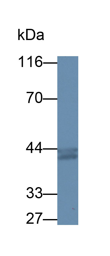 Monoclonal Antibody to Actin Alpha 2, Smooth Muscle (ACTa2)