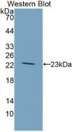 Monoclonal Antibody to Glucokinase Regulatory Protein (GKRP)