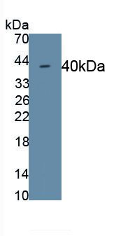 Monoclonal Antibody to Cadherin 5 (CDH5)