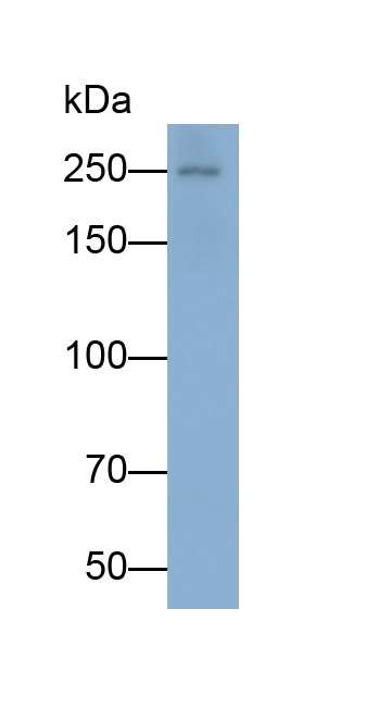 Monoclonal Antibody to Vascular Endothelial Growth Factor Receptor 2 (VEGFR2)