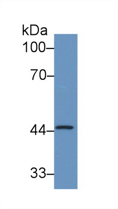 Monoclonal Antibody to Serpin B3 (SERPINB3)