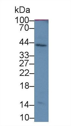 Monoclonal Antibody to Serpin B3 (SERPINB3)