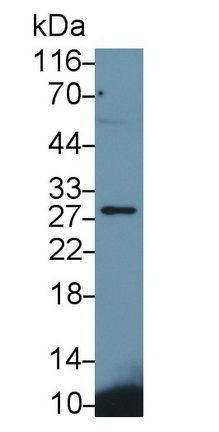 Monoclonal Antibody to Cluster of Differentiation 79B (CD79B)