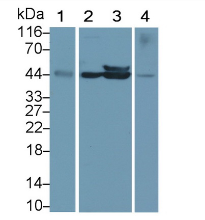 Monoclonal Antibody to Cluster of Differentiation 79B (CD79B)