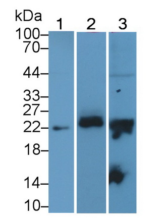 Monoclonal Antibody to Neutrophil gelatinase-associated lipocalin (NGAL)