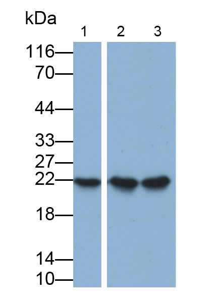 Monoclonal Antibody to Neutrophil gelatinase-associated lipocalin (NGAL)