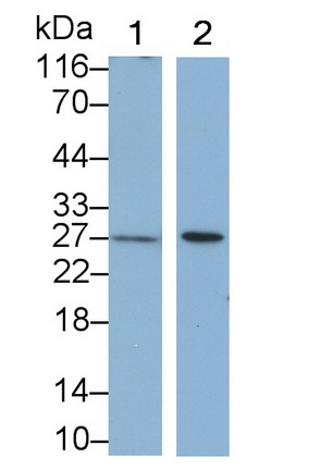 Monoclonal Antibody to Neutrophil gelatinase-associated lipocalin (NGAL)