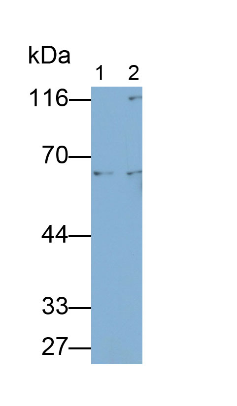 Monoclonal Antibody to Lipopolysaccharide Binding Protein (LBP)