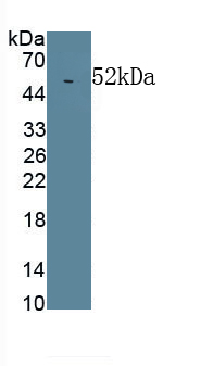 Monoclonal Antibody to Lipopolysaccharide Binding Protein (LBP)