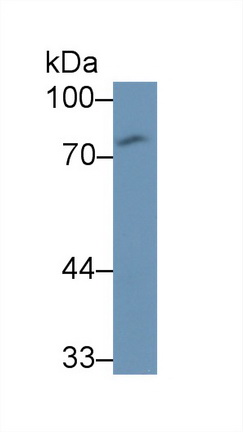 Monoclonal Antibody to Cluster Of Differentiation 97 (CD97)