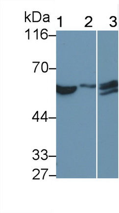 Monoclonal Antibody to Interferon Alpha/Beta Receptor 1 (IFNa/bR1)