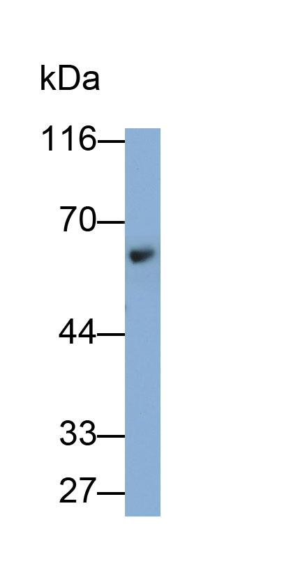 Monoclonal Antibody to Tyrosine Hydroxylase (TH)