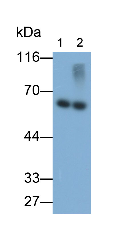 Monoclonal Antibody to Tyrosine Hydroxylase (TH)