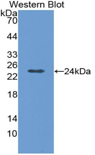Monoclonal Antibody to Acetylcholinesterase (ACHE)