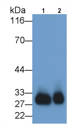 Monoclonal Antibody to Azurocidin (AZU)