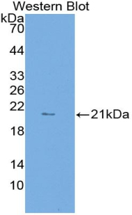 Monoclonal Antibody to Lysosomal Associated Membrane Protein 2 (LAMP2)