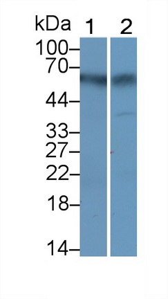 Monoclonal Antibody to Salivary Alpha Amylase (AMY1A)