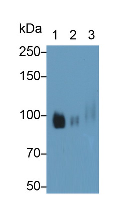 Monoclonal Antibody to Colony Stimulating Factor Receptor, Macrophage (MCSFR)