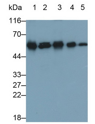 Monoclonal Antibody to Calreticulin (CALR)