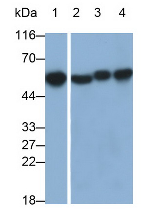 Monoclonal Antibody to Calreticulin (CALR)