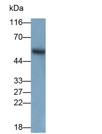 Monoclonal Antibody to Calreticulin (CALR)