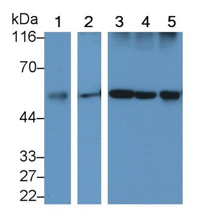 Monoclonal Antibody to Calreticulin (CALR)