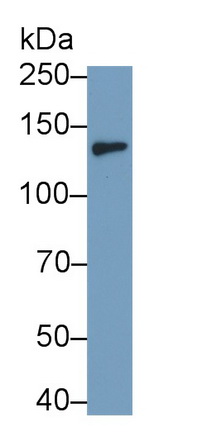 Monoclonal Antibody to Colony Stimulating Factor 2 Receptor Beta (CSF2Rb)