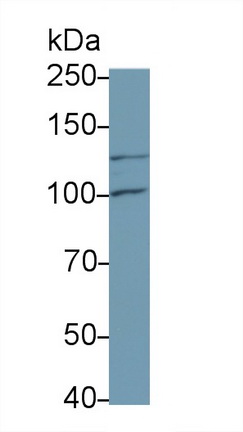 Monoclonal Antibody to Colony Stimulating Factor 2 Receptor Beta (CSF2Rb)