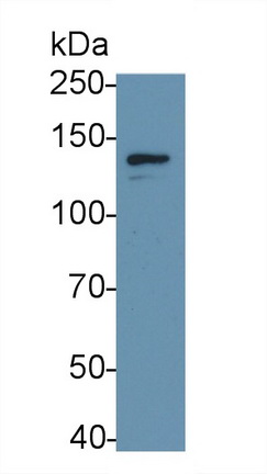 Monoclonal Antibody to Colony Stimulating Factor 2 Receptor Beta (CSF2Rb)