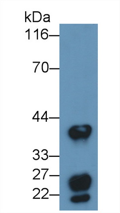 Monoclonal Antibody to Cluster Of Differentiation 147 (CD147)