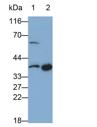 MAB546Hu21.jpg