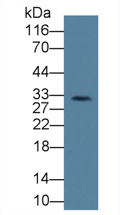 Monoclonal Antibody to Killer Cell Immunoglobulin Like Receptor 2DS4 (KIR2DS4)